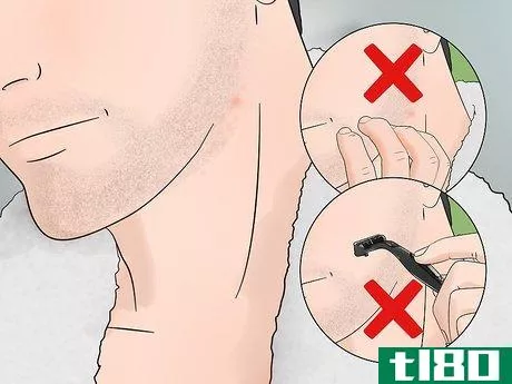 Image titled Stop Itching After Shaving Step 1