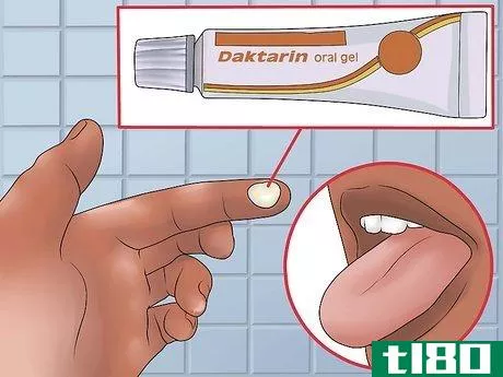 Image titled Treat Oral Thrush Step 12