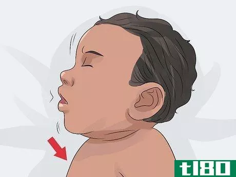 Image titled Spot Meningitis in Babies Step 5
