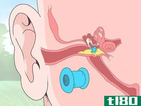 Image titled Tell if You Have an Ear Infection Step 16