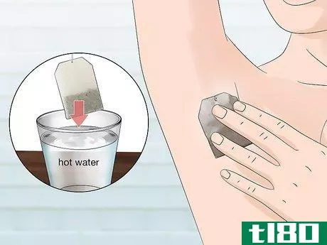 Image titled Stop Armpit Pimples Step 9