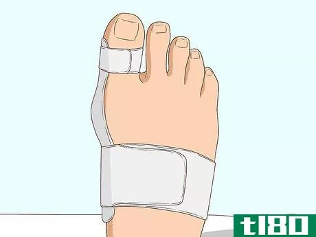 Image titled Stop a Bunion from Growing Step 8