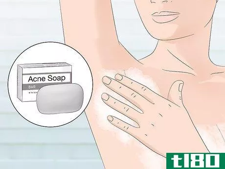 Image titled Stop Armpit Pimples Step 11