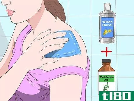 Image titled Stop Mosquito Bites from Itching Step 16