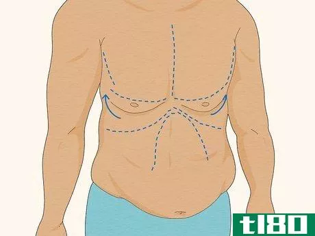 Image titled Tighten Skin After Weight Loss Step 12
