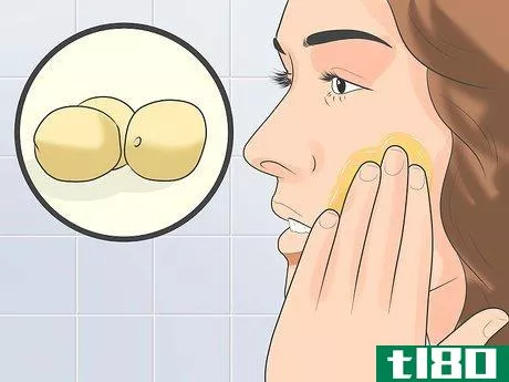 Image titled Treat Cystic Acne Naturally Step 14