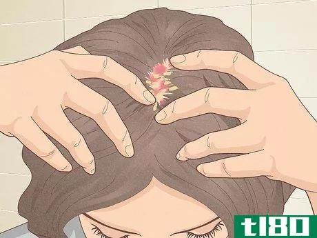 Image titled Bumps on Scalp Step 16