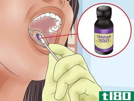 Image titled Treat Oral Thrush Step 4