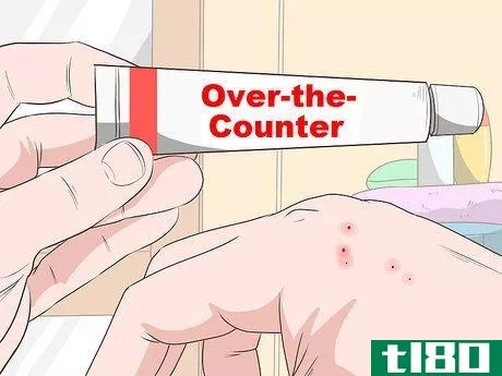 Image titled Stop Mosquito Bites from Itching Step 7