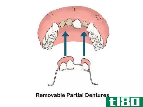 Image titled Buy Dentures Step 5