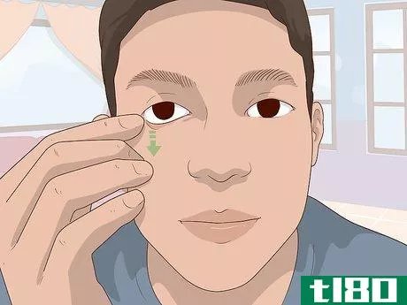 Image titled Clean a Prosthetic Eye Step 5.jpeg