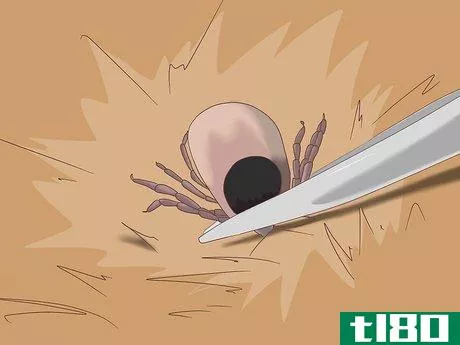Image titled Remove Ticks from Furry Pets Step 5