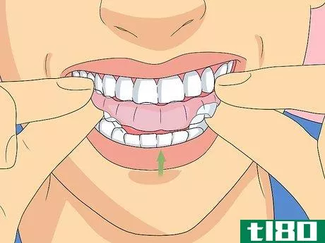 Image titled Clean Invisalign Step 11