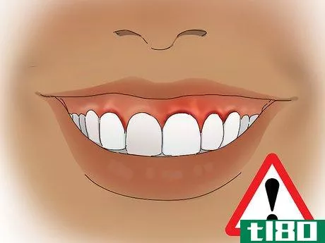 Image titled Buy Dentures Step 8