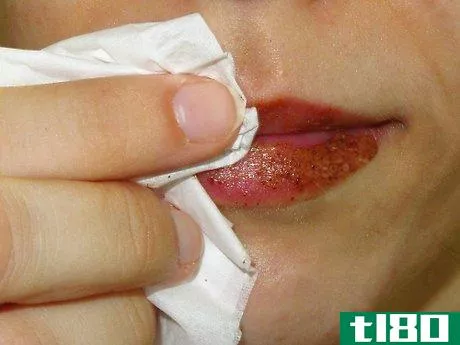 Image titled Make Your Own Lip Plumper at Home Step 7