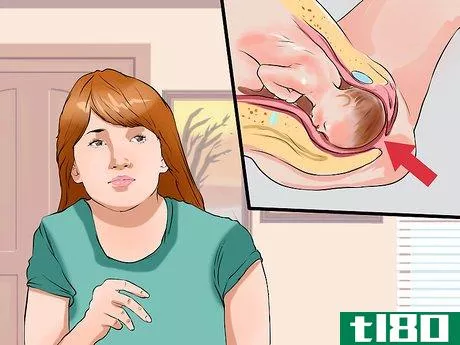 Image titled Care for an Episiotomy Postpartum Step 14