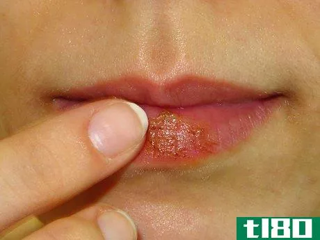 Image titled Make Your Own Lip Plumper at Home Step 15