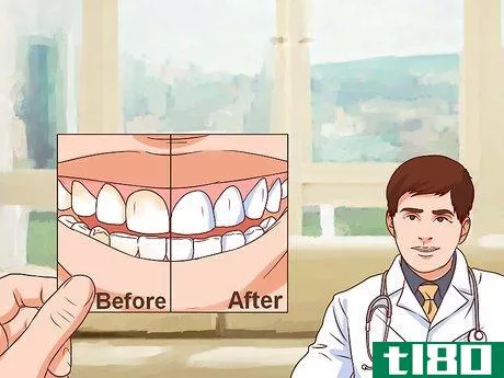 Image titled Choose a Cosmetic Dentist Step 11