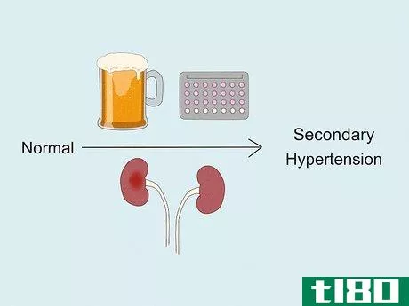 Image titled Determine If You Have Hypertension Step 10
