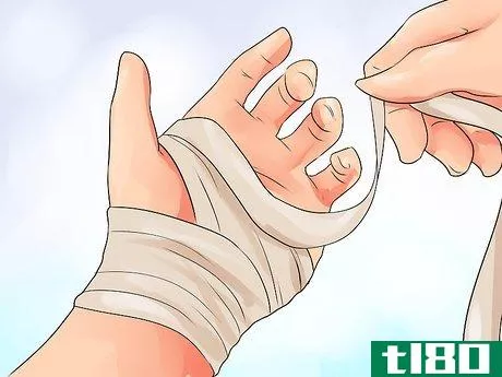 Image titled Exercise After Carpal Tunnel Surgery Step 7