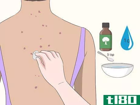 Image titled Get Rid of Back Acne Scars Step 5