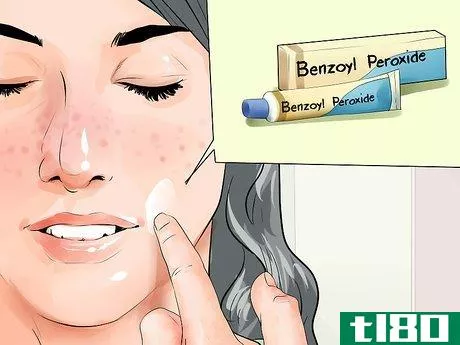 Image titled Get Rid of Acne in One Week Step 5