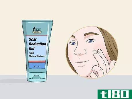 Image titled Get Rid of Acne With Home Remedies Step 12