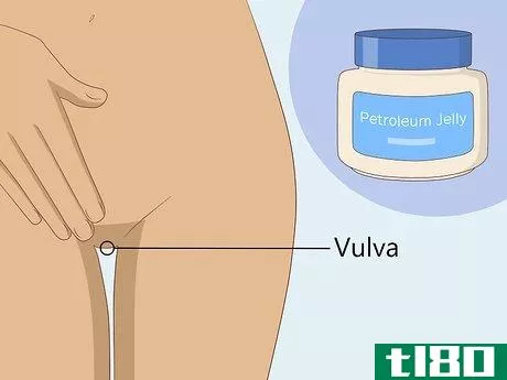 Image titled Get Rid of a Yeast Infection at Home Step 11