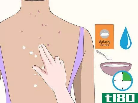 Image titled Get Rid of Back Acne Scars Step 6