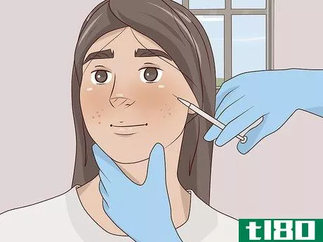 Image titled Get Rid of Acne Scars Naturally Step 11