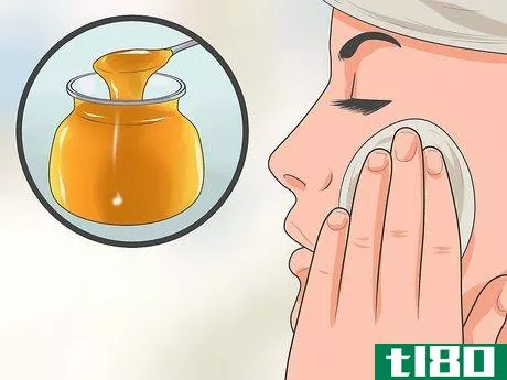 Image titled Get Rid of Acne With Home Remedies Step 10