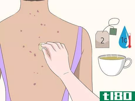 Image titled Get Rid of Back Acne Scars Step 7