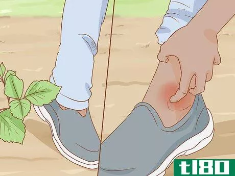 Image titled Get Rid of Poison Ivy Rashes Step 2