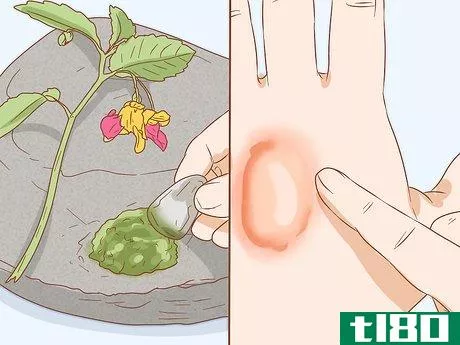 Image titled Get Rid of Poison Ivy Rashes Step 6