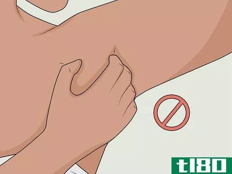Image titled Heal Armpit Rash Step 6