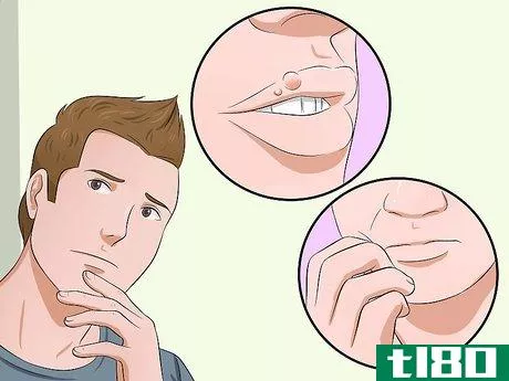 Image titled Heal Cold Sores Step 1