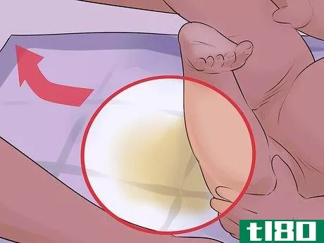 Image titled Help a Male Child Provide a Urine Sample Step 32