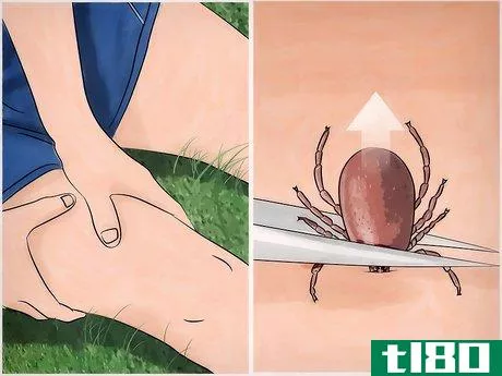 Image titled Get Rid of Ticks Around Your Home Step 16