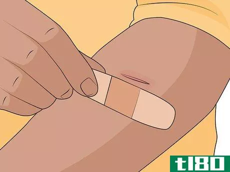 Image titled Test the Effectiveness of a Bandage Step 11