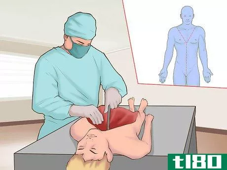 Image titled Perform an Autopsy on a Human Being Step 8