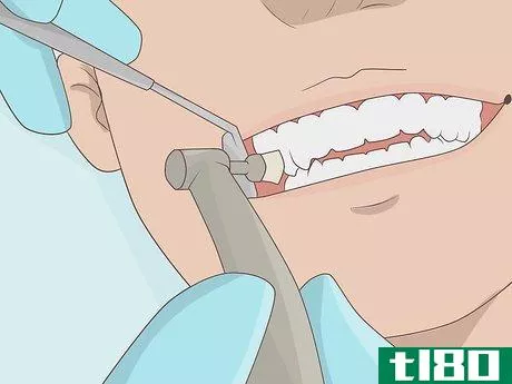 Image titled Prevent a Root Canal Step 5