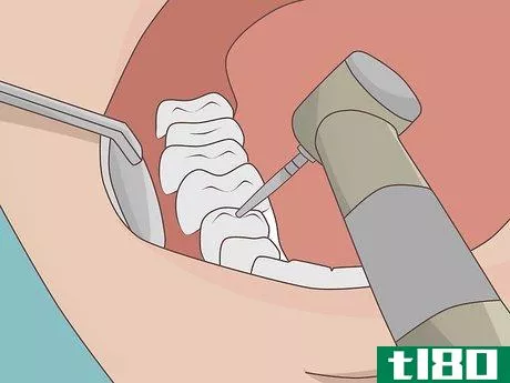 Image titled Prevent a Root Canal Step 13