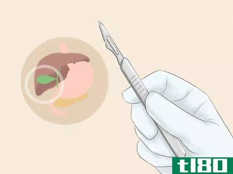Image titled Relieve Biliary Colic Pain Step 10