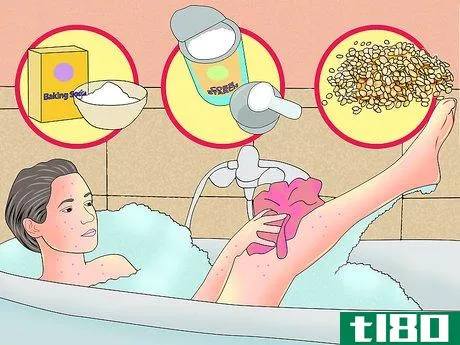 Image titled Relieve Itching from Chickenpox Step 3