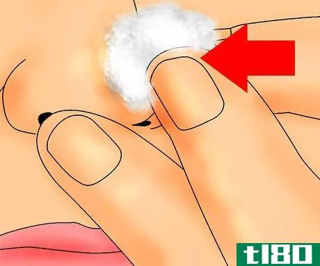 Image titled Remove Blackheads and Whiteheads with a Comedo Extractor Step 8