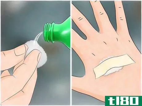 Image titled Reduce the Pain of Gnat Bites Step 2