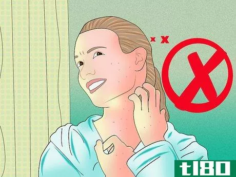 Image titled Relieve Itching from Chickenpox Step 1