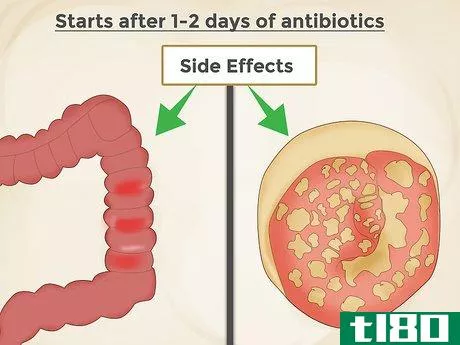 Image titled Take Antibiotics with Probiotics Step 2