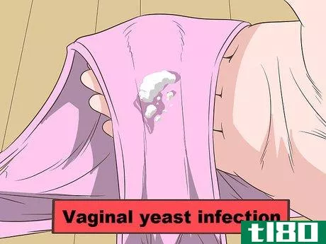 Image titled Tell if Vaginal Discharge Is Normal Step 14