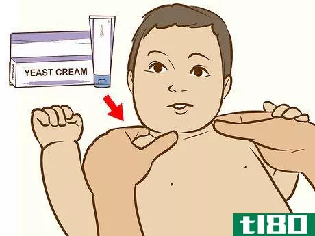 Image titled Treat Neck Rashes for Your Baby Step 5
